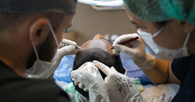 hair transplant, treatment, surgery, procedure, scalp, dermatology, hair transplant, hair transplant, hair transplant, hair transplant, hair transplant